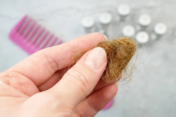 Problema Pérdida Cabello Botellas Con Medicina Cepillo Para Cabello Bollo —  Fotos de Stock