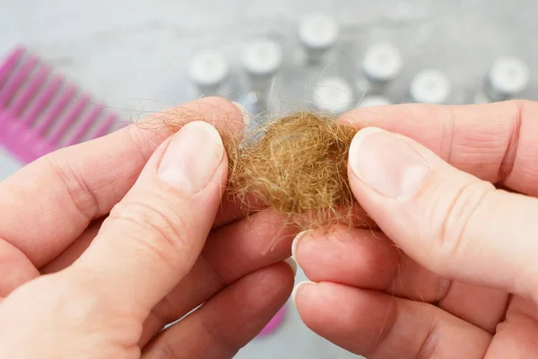 Hair Loss Problem Bottles Medicine Hairbrush Hair Bun Alternative Treatments — Stock Photo, Image