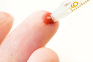 Beyaz arka planda kırmızı kan damlası olan el, tıbbi test konsepti