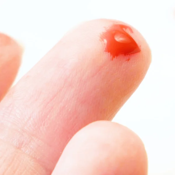 Mano Con Gota Sangre Roja Sobre Fondo Blanco Concepto Prueba — Foto de Stock