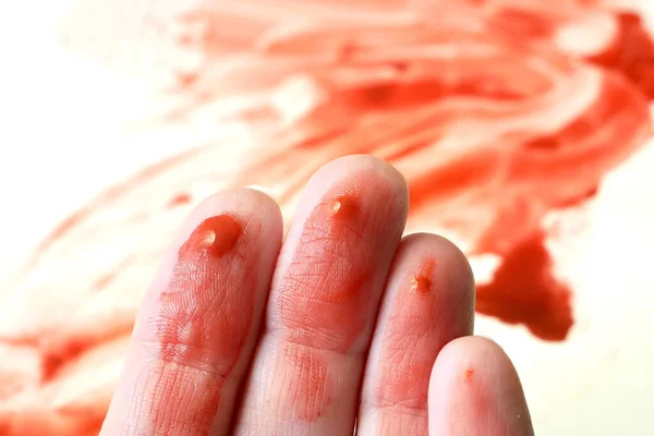 Arka Planda Beyaz Bir Yüzey Üzerinde Kan Kan Içinde Eller — Stok fotoğraf