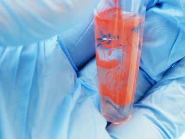 Laboratuvarda kan örneğiyle test tüpleri, yakın plan.