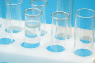 Laboratuvarda kan örneğiyle test tüpleri, yakın plan.