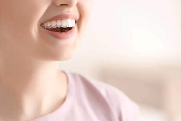 Woman Occlusal Splint Light Background Closeup — Stock Photo, Image