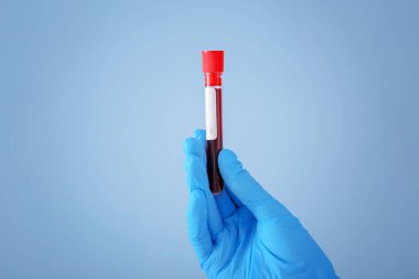 Tüp kan örneği ile renk arka plan üzerinde tutarak laboratuar işçisi