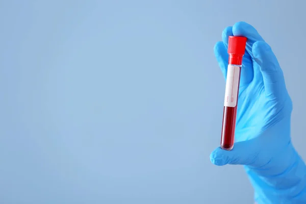 Tüp Kan Örneği Ile Renk Arka Plan Üzerinde Tutarak Laboratuar — Stok fotoğraf