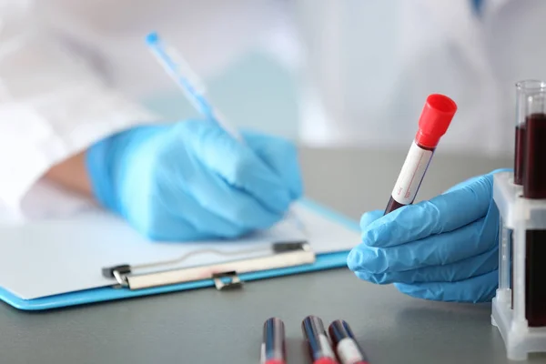 Woman Working Blood Sample Test Tube Table — Stock Photo, Image