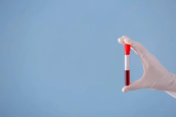 Lab Worker Holding Test Tube Blood Sample Color Background — Stock Photo, Image