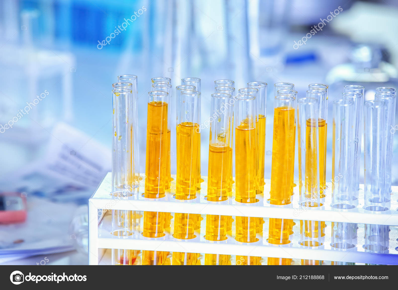 Reagenzgläser Mit Proben Auf Dem Tisch Labor – Stockfoto © serezniy  #212188868, image size:1600x1167