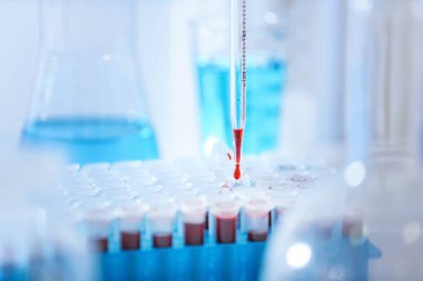 Laboratuvar test tüpleri içine Kan damlayan