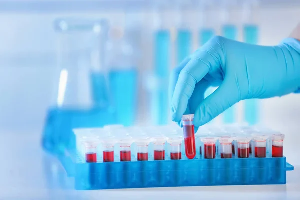 Científico Trabajando Con Tubos Ensayo Laboratorio — Foto de Stock