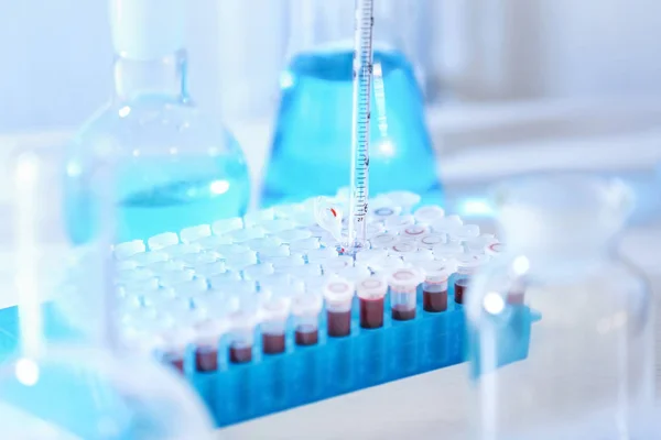 Dripping Blood Test Tubes Laboratory — Stock Photo, Image