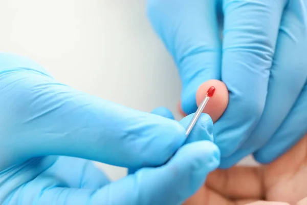 Doctor Using Lancet Get Blood Sample Test Closeup — Stock Photo, Image