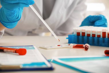 Laboratuvar kan örneğinde ile çalışan kadın