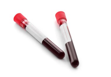 Beyaz arka plan üzerinde kan örnekleri ile test tüpleri