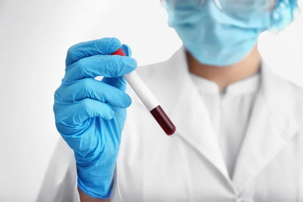 Laboratory Assistant Holding Test Tube Blood Sample Light Background — Stock Photo, Image