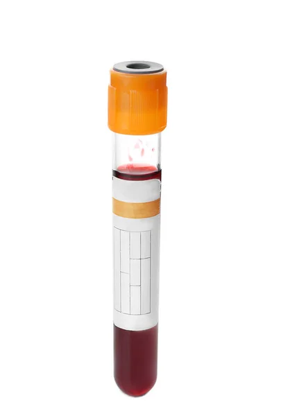 Test Tube Blood Sample White Background — Stock Photo, Image