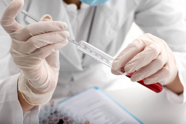 Mujer Trabajando Con Muestra Sangre Laboratorio Primer Plano — Foto de Stock