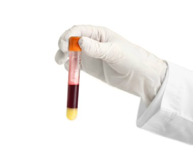 Laboratuar asistanı holding tüp kan örneği beyaz zemin üzerine el