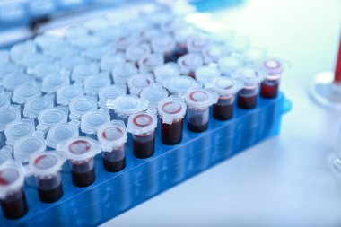 Laboratuvarda üzerinde kan örnekleri olan test tüpleri, yakın plan.