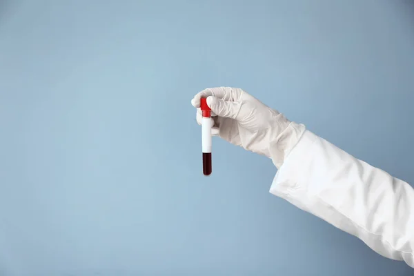 Hand Laboratory Assistant Holding Test Tube Blood Sample Color Background — Stock Photo, Image