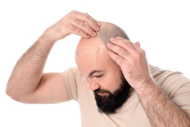Adam beyaz arka plan üzerinde saç dökülmesi sorunu ile