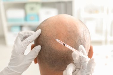 Erkek saç dökülmesi sorunu alıcı enjeksiyon kliniği ile