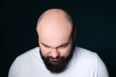 Saç dökülmesi sorunu koyu arka plan üzerinde olan adam