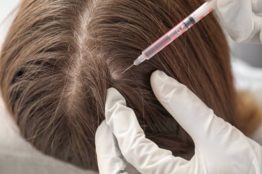 Kadın saç dökülmesi sorunu alıcı enjeksiyon Kliniği, closeup ile
