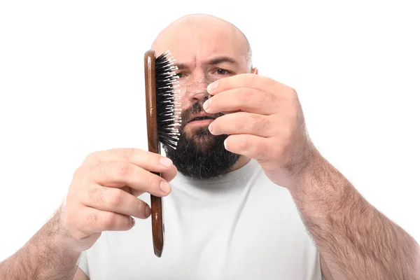 Homme Avec Problème Perte Cheveux Sur Fond Blanc — Photo