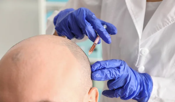 Erkek Saç Dökülmesi Sorunu Alıcı Enjeksiyon Kliniği Ile — Stok fotoğraf