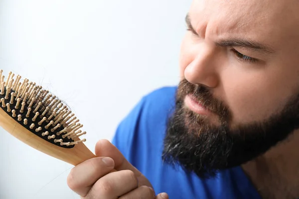 Pria Dengan Masalah Kehilangan Rambut Pada Latar Belakang Cahaya Close — Stok Foto