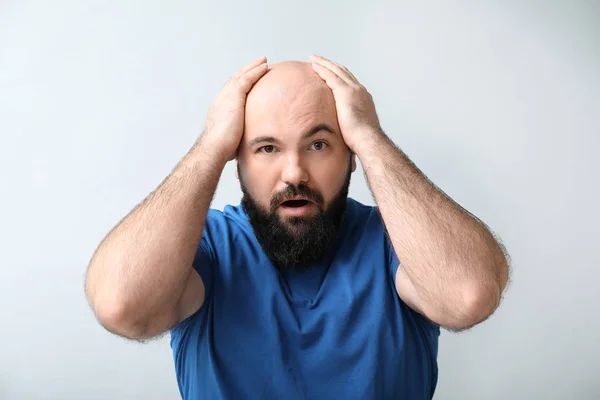 Man Hair Loss Problem Light Background — Stock Photo, Image