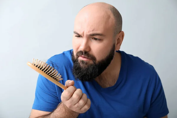 Man Hair Loss Problem Light Background — Stock Photo, Image