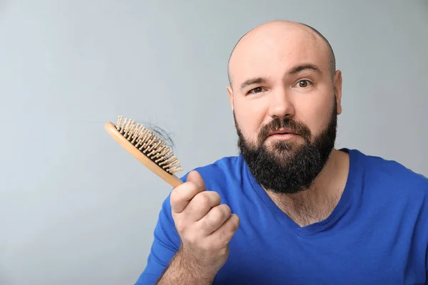 Man Hair Loss Problem Light Background — Stock Photo, Image