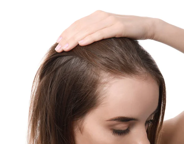 Kadın Saç Dökülmesi Problemi Beyaz Arka Planda Closeup Ile — Stok fotoğraf