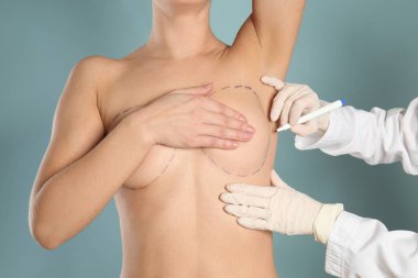 Doktor kadın meme renk arka plan karşı kozmetik cerrahi operasyondan önceki işaretleri çizim