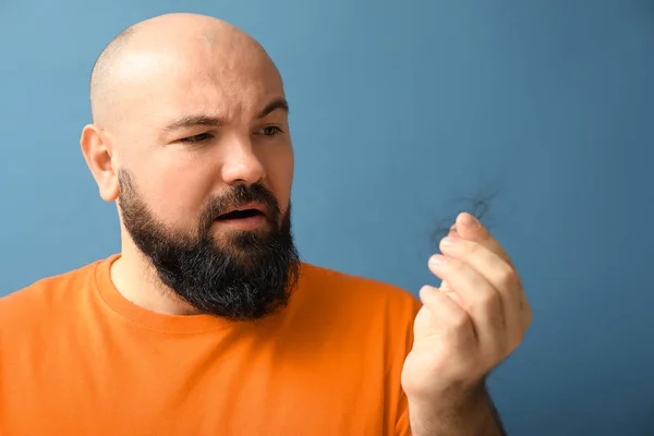 Pria Dengan Masalah Kehilangan Rambut Pada Latar Belakang Warna — Stok Foto