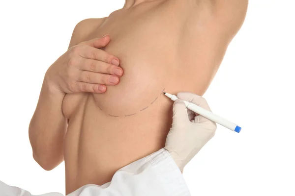 白底美容外科手术前 医生在女性乳房上画上记号 — 图库照片