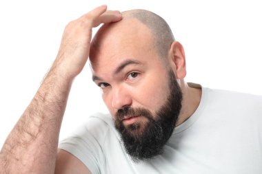 Adam beyaz arka plan üzerinde saç dökülmesi sorunu ile