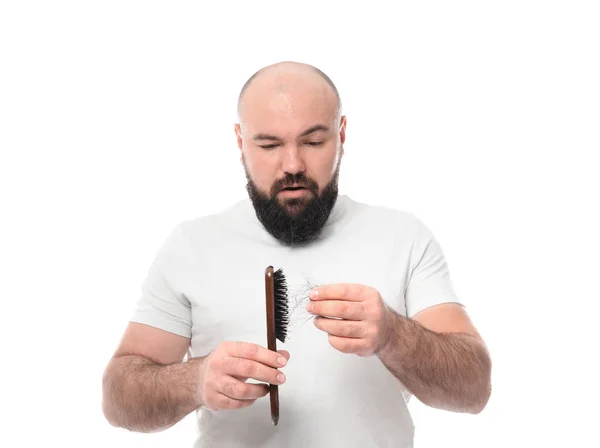 Pria Dengan Masalah Kehilangan Rambut Pada Latar Belakang Putih — Stok Foto