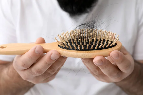 Homme Avec Problème Perte Cheveux Gros Plan — Photo