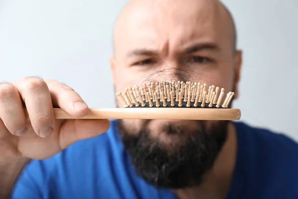 Pria Dengan Masalah Kehilangan Rambut Pada Latar Belakang Cahaya — Stok Foto