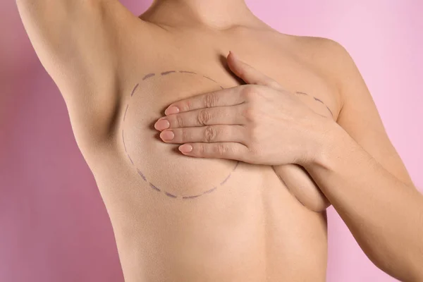 Young woman with marks on breast for cosmetic surgery operation against color background