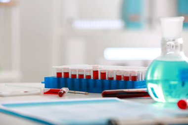 Kan örnekleri laboratuvar tablo ile test tüpleri