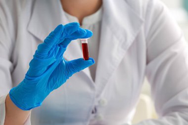 Kan örneği laboratuvar, closeup ile çalışan kadın