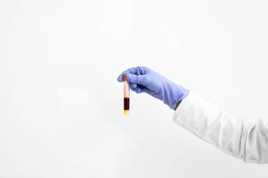 Laboratuar asistanı holding tüp kan örneği beyaz zemin üzerine el