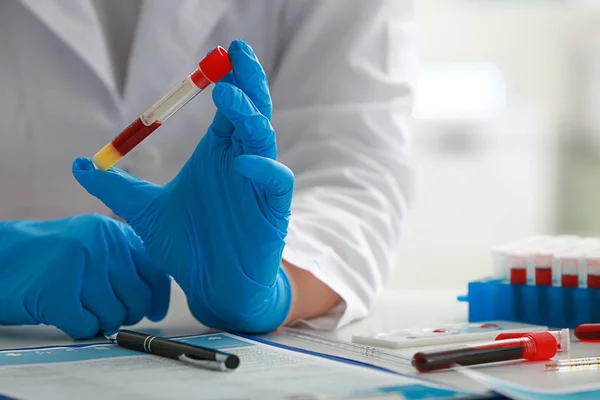 Woman Working Blood Sample Laboratory Closeup — Stock Photo, Image