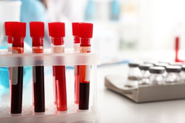 Laboratuvarda üzerinde kan örnekleri olan test tüpleri, yakın plan.