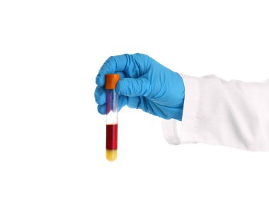 Laboratuar asistanı holding tüp kan örneği beyaz zemin üzerine el